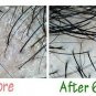 Best Natural Set Kowbu Shampoo Hair Tonic Stimulation Hair Loss Regrowth + Serum