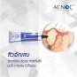 ACNOC Acneser Spot Gel Acne Facial recoveries Treatment Acne in 4 hours 10 g.
