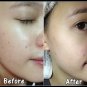 SNAIL SOAP WHITEN AND ACNE 10 X SPEED WHITENING& ACNE BODY AND FACE SKIN 70 g.