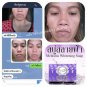 CLEAR MELASMA WHITENING SOAP REDUCE DARK SPOTS AND MELASMA WITH NATURAL 50 G.