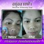CLEAR MELASMA WHITENING SOAP REDUCE DARK SPOTS AND MELASMA WITH NATURAL 50 G.
