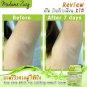 2 boxes Armpit, Knee, Elbow, Whitening Cream Aloe Vera 99% Clear roughness skin.