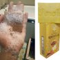 TURMERIC HONEY SCRUB HERBAL SOAP REDUCE ACNE,DARK SPOTS BY NATURAL INGREDIENTS.