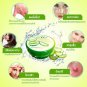 ALOVERA GEL 100% NATURAL REDUCE SCAR & INFUSING MOISTURE SKIN 50 G. + FREE SHIP