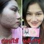 EXPRESS SHIP 5 Pcx. BEST OF WHITE AURA CARROT ACNE SOAP AND OILY SKIN 160 G.