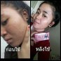 EXPRESS SHIP 5 Pcx. BEST OF WHITE AURA CARROT ACNE SOAP AND OILY SKIN 160 G.
