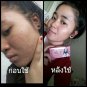 5 BARS x POPULAR WHITE AURA CARROT ACNE SOAP AND OILY SKIN 160 G. FREE EXPRESS