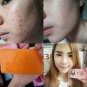 5 BARS x POPULAR WHITE AURA CARROT ACNE SOAP AND OILY SKIN 160 G. FREE EXPRESS