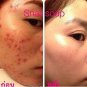 5 BOXES x SNAIL WHITE SOAP GLUTATHIONE X10 WHITENING SKIN/ANTI AGING/REDUCE ACNE