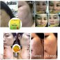 2xHo Yeon Anti-Blemish Facial  Detox Soap Whitening Clear Spot Reduce Acne 70 g.
