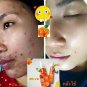 NATURAL INTENSIVE VITAMIN C LIQUID SOAP CLEANSING REDUCE ACNE,ACNE SPOTS 100 ML.