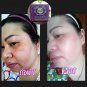 2 Bars x MELASMA WHITENING SOAP REDUCE DARK SPOTS AND MELASMA WITH NATURAL 50 G.