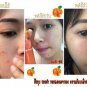 NATURAL VITAMIN C SOAP DEEP CLEANSING AND REDUCE ACNE GOOD RESULTS 100 ML.