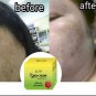 NEW!! HO-YEON ANTI-MALESMA FACIAL SOAP NATURAL INGREDIENTS RESTORE BRIGHTEN SKIN