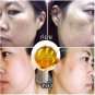 NEW!! HO-YEON ANTI-MALESMA FACIAL SOAP NATURAL INGREDIENTS RESTORE BRIGHTEN SKIN