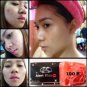 CLEAR ACNE NATURAL SOAP BY ALERT KISS ,REDUCE RED ACNE , ANTI-AGING 80 G.