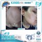 KAYBEVIE PREMIUM MINERAL SOAP WITH SNOW EXTRACT CLEAR ACNE/SENSITIVE SKIN 40 G.