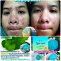 3 pcs.Ho Yeon Facial Herbal Blue Soap Detox face skin Reduce Acne and Deep clean