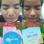 3 pcs.Ho Yeon Facial Herbal Blue Soap Detox face skin Reduce Acne and Deep clean