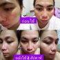 NEW++MELASMA WHITENING SOAP REDUCE DARK SPOTS AND MELASMA WITH NATURAL 50 G.