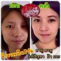 BFC CAMU WHITENING FACIAL SOAP WITH  PHYTO ESC REDUCE FRECKLES,DARK SPOT ON FACE