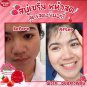 Strawberry serum brighten facial soap for reduce Steroid acne/ Acne spots 80 g.