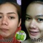 RECOMMENDED !!3D SMOOTH ALOE SOAP FOR REDUCE ACNE/REDUCE STEROID/SPOT 50 G.+