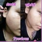 Pervious Restoring Facial Soap Clear Acne and Brightness your skin 100 g.