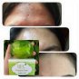 BFC FACIAL OIL CONTROL SOAP WITH GREEN TEA VITAMIN C,E REDUCE BLACKHEAD/ ACNE70g