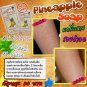 BEST SELLER!! AHA 80%+ALPHA ARBUTIN REDUCE BODY RASH  AND DARK SPOT FROM RASH