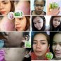 3D SMOOTH ALOE SOAP FOR REDUCE ACNE/STEROID ACNE/ FOR ALLERGIC&SENSITIVE SKIN