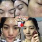 GOOD RESULTS!! for reduce Steroid acne 30 g. Strawberry mask facial soap .+++