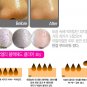 Lioele Blackhead Clear