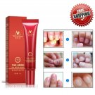 Herbal Nail Treatment Cream Onychomycosis Paronychia Anti Fungal Nail Infection