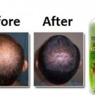 Kokliang Kok Liang Anti-hair Loss Dandruff Herbal Scalp Soothe Shampoo 200cc