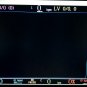 ISA SBC Video Card, Imagine 128 + s3 968 + i960, WORKING, Witt Biomedical
