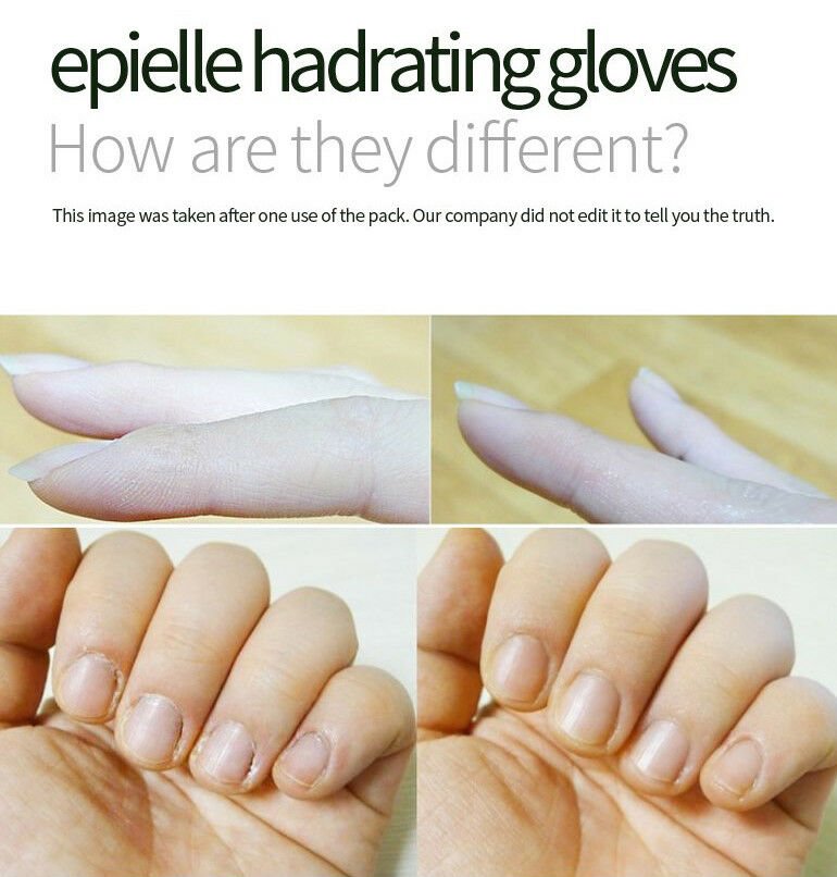Epielle Moisturizing Gloves Sunflower Seed Oil + Avocado Oil + Vitamin E 1 Pair