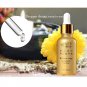 Anti Fungal Nail Treatment Toe Nail Finger Fungus Onychomycosis Thickened 30ML