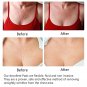 Anti Wrinkle Chest Pad Silicon Eliminate Wrinkles Removal Reusable Anti aging 1p