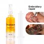 Portable Laser Pen Mole Freckle Scars Wart Removal Machine / Repair Factor 10ml