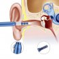 Visual Ear Cleaner Inspection Camera Endoscope Earpick Curette Earwax Removal