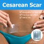 Efficient Caesarean Silicone Gel Removal Scar Sheet Trauma Burn Scar Skin Repair
