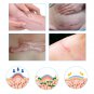 Efficient Caesarean Silicone Gel Removal Scar Sheet Trauma Burn Scar Skin Repair