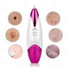Portable Mole Freckle Removal Pen Machine Laser Spot Moles Tattoo Remover Device