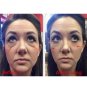 50pcs Anti Jeunesse Face Ageless Instantly Cream Wrinkle Eye, Aging Serum Ageing