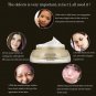 JIUNAER - Whitening, Remove Freckle, Melanin Eliminate, Spot Skin Dark Removal