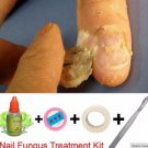 Chinese Medicine Herbs Toe Nail Fungus Treatment Anti Fungal Nail Infection Kit