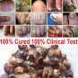 Chinese Medicine Herbs Toe Nail Fungus Treatment Anti Fungal Nail Infection Kit