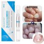 ORIGINAL! Euconychia - Herbal Nail Fungus Treatment Pen Biological Repair Pencil
