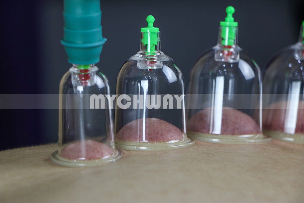 12 Chinese Body Cupping Cups Set Magnet Massage Suction Vacuum Therapy Healthy